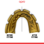 Opro Instant Custom Fit for Braces before and after fitting